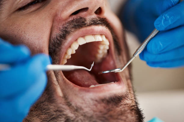 Emergency Dental Services in Fairfax, OH
